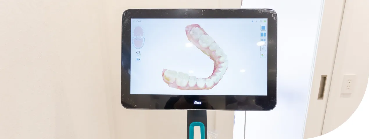 美しく長持ちする治療